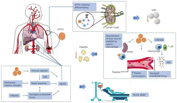 Research Progress of Fever with Thrombocytopenia Syndrome.