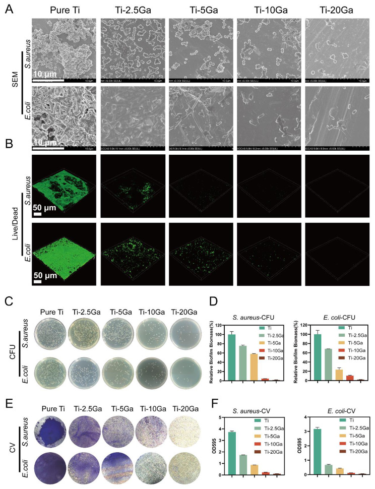 A dual functional Ti-Ga alloy: inhibiting biofilm formation and osteoclastogenesis differentiation via disturbing iron metabolism.