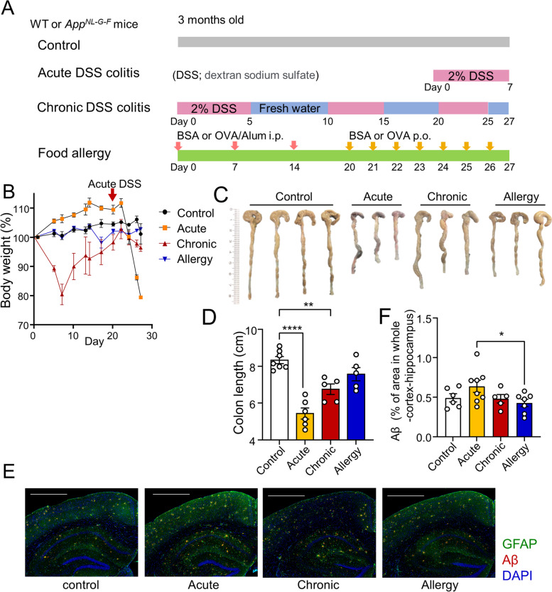 Increased neutrophils in inflammatory bowel disease accelerate the accumulation of amyloid plaques in the mouse model of Alzheimer's disease.