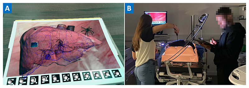 Enhanced Surgeons: Understanding the Design of Augmented Reality Instructions for Keyhole Surgery.