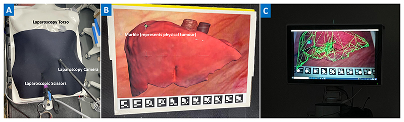 Enhanced Surgeons: Understanding the Design of Augmented Reality Instructions for Keyhole Surgery.