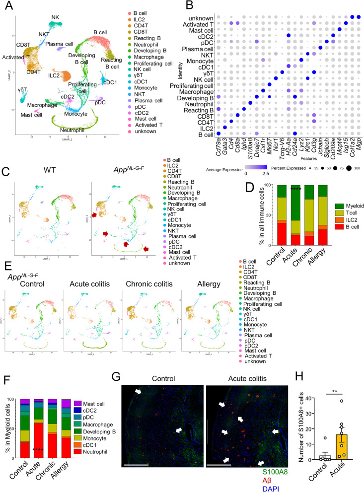 Increased neutrophils in inflammatory bowel disease accelerate the accumulation of amyloid plaques in the mouse model of Alzheimer's disease.