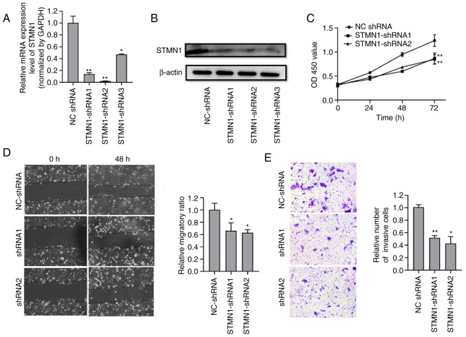 Stathmin1 promotes lymph node metastasis in hypopharyngeal squamous cell carcinoma via regulation of HIF‑1α/VEGF‑A axis and MTA1 expression.