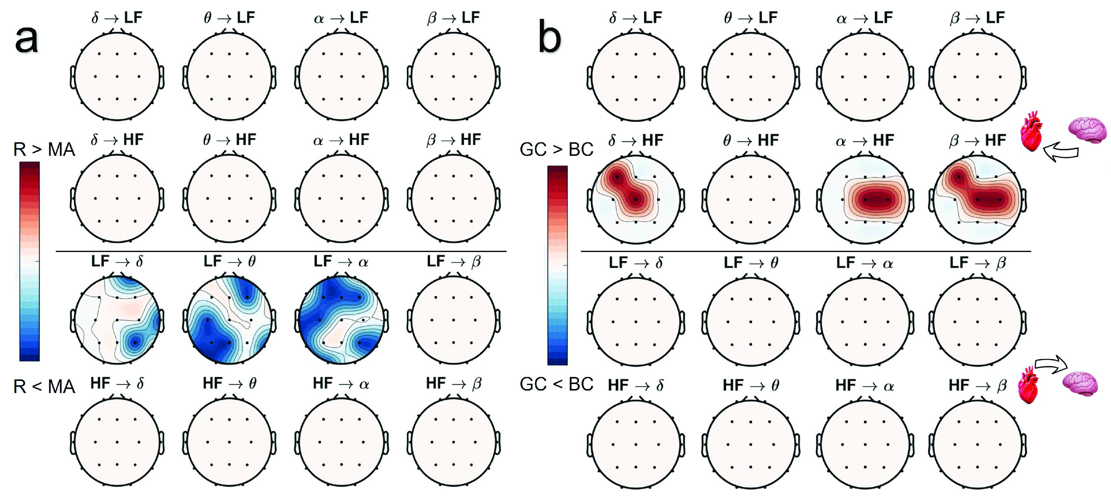 Complex Brain–Heart Mapping in Mental and Physical Stress