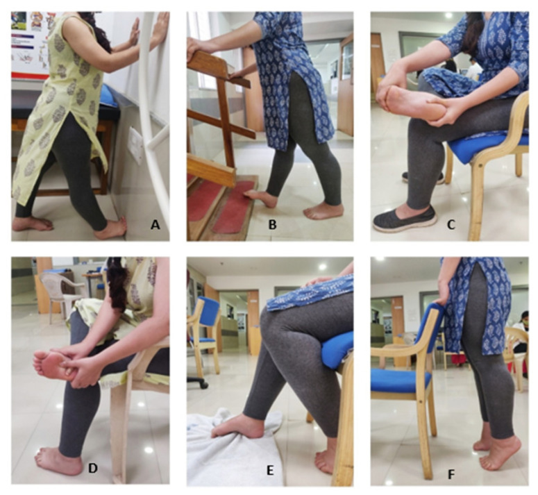 Comparative Effectiveness of Gua Sha, Cryostretch, and Positional Release Technique on Tenderness and Function in Subjects with Plantar Fasciitis: a Randomized Clinical Trial.