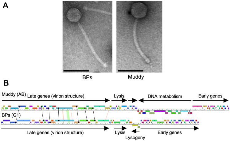 Phage Therapy for Nontuberculous Mycobacteria: Challenges and Opportunities.