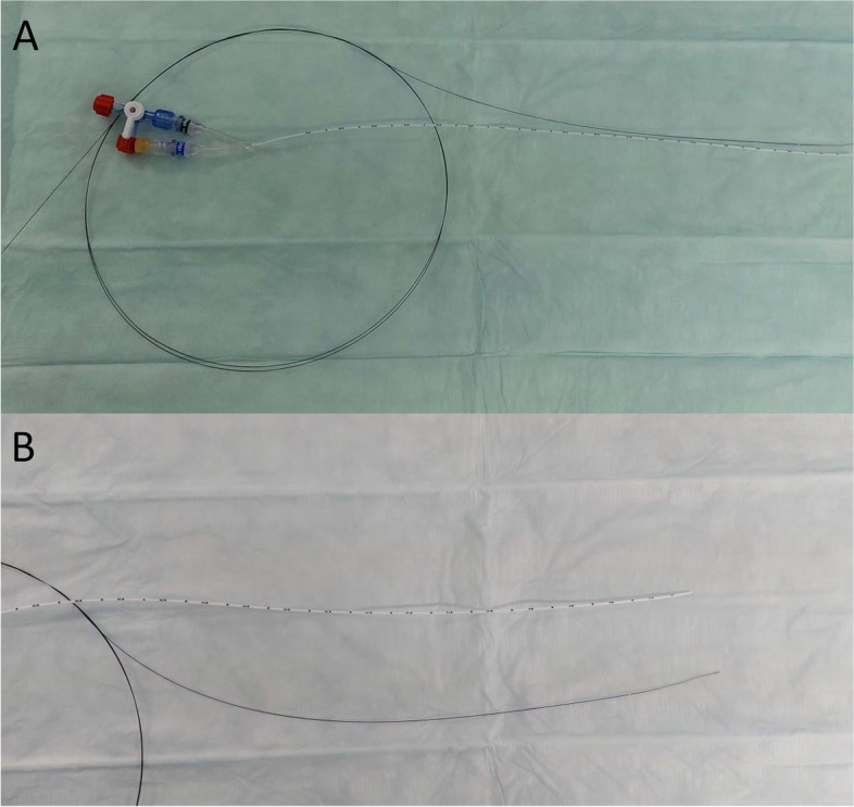 Umbilical catheter placement aided by coronary guidewires.