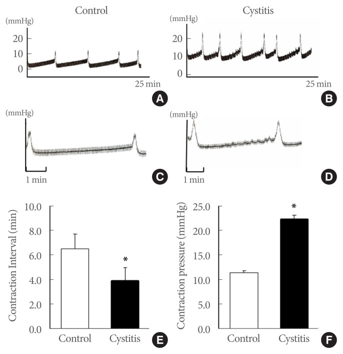 Decreased Expression of Urethral Caveolin-1, -2, and -3 in the Rat Model of Overactive Bladder: Potential Mediator of Functional Interaction of Urethra and Urinary Bladder.