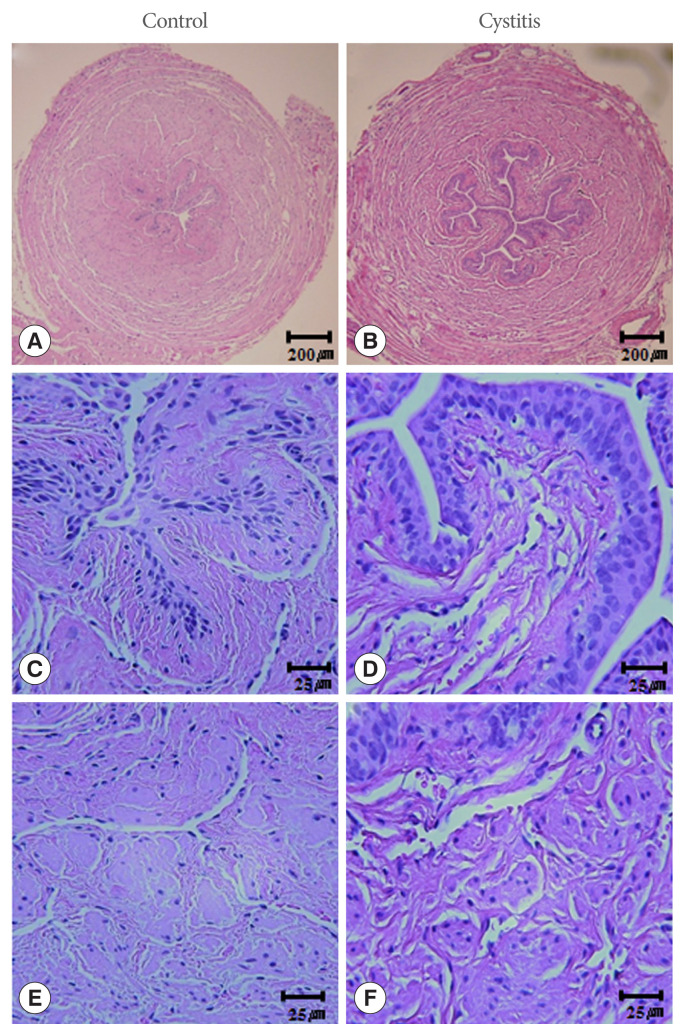 Decreased Expression of Urethral Caveolin-1, -2, and -3 in the Rat Model of Overactive Bladder: Potential Mediator of Functional Interaction of Urethra and Urinary Bladder.