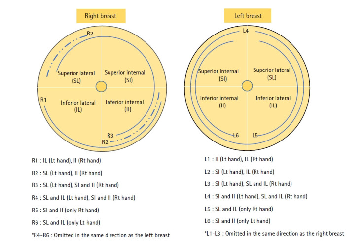 A randomized controlled trial of pectoralis major myofascial release massage for breastfeeding mothers: breast pain, engorgement, and newborns' breast milk intake and sleeping patterns.