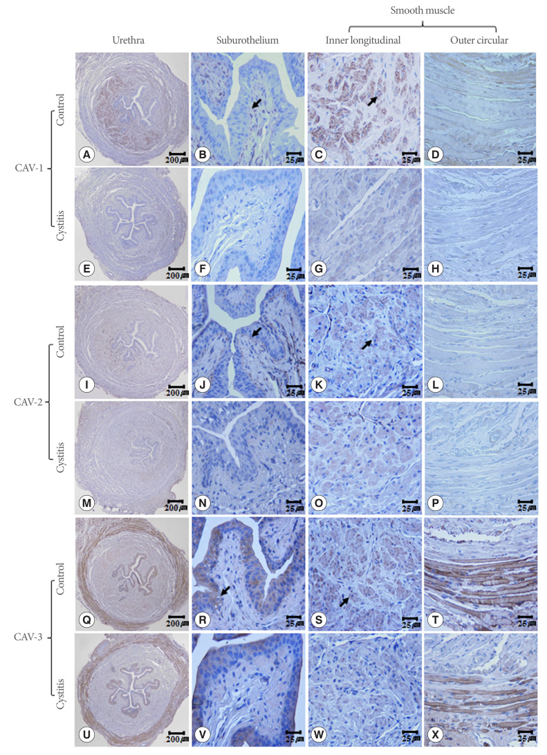 Decreased Expression of Urethral Caveolin-1, -2, and -3 in the Rat Model of Overactive Bladder: Potential Mediator of Functional Interaction of Urethra and Urinary Bladder.