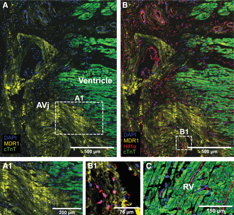 Expression of Stem Cell Niche-Related Biomarkers at the Base of the Human Tricuspid Valve.