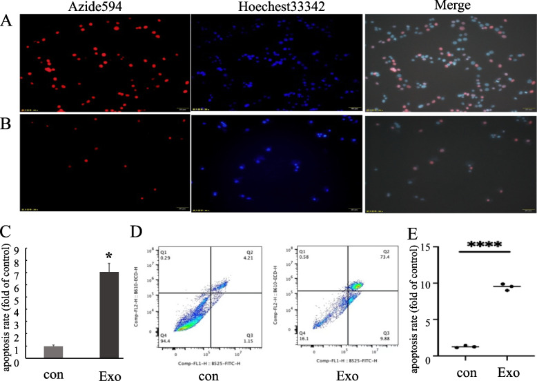 Influence of Exosomes on Astrocytes in the Pre-Metastatic Niche of Lung Cancer Brain Metastases.