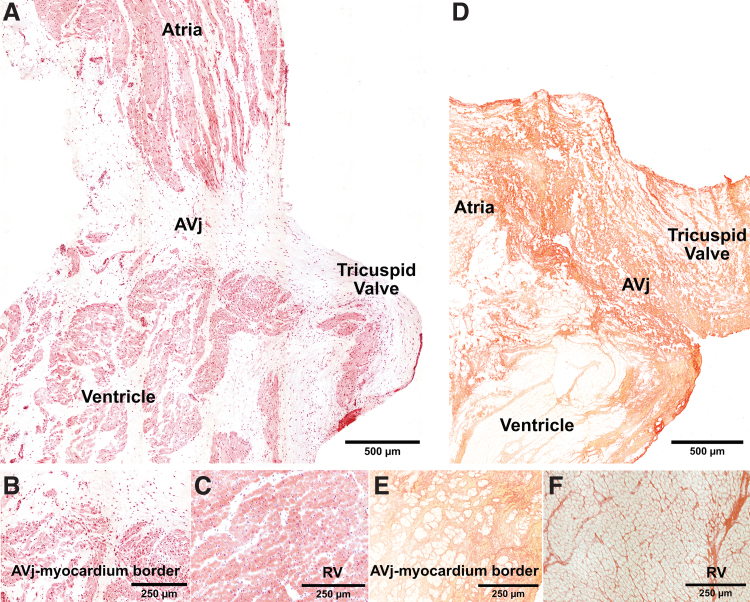 Expression of Stem Cell Niche-Related Biomarkers at the Base of the Human Tricuspid Valve.