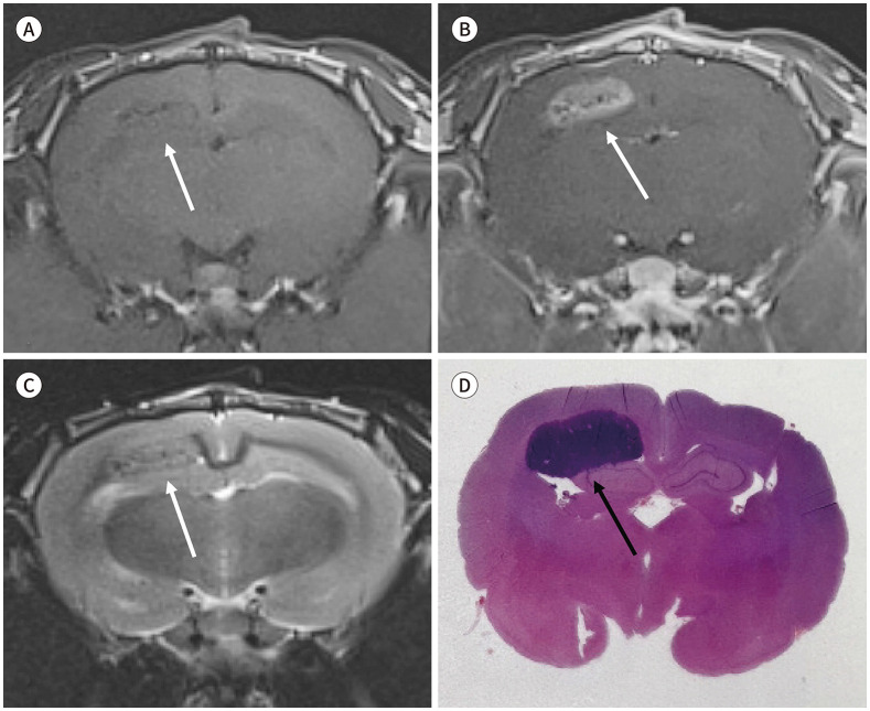 [Development of Rabbit Brain Tumor Model Using VX2 Cells and Verification with the MRI in Neuroradiologic Research].