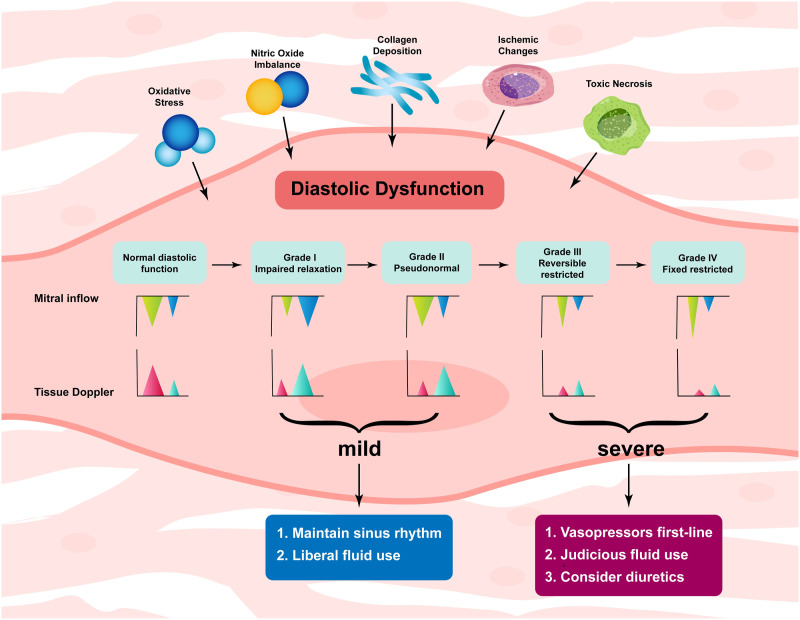 Managing Diastolic Dysfunction Perioperatively.