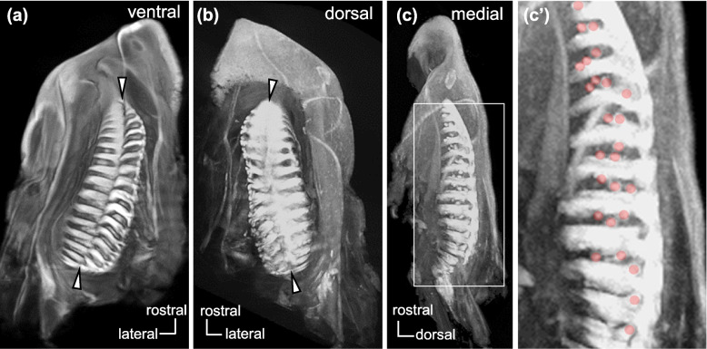 Type 1 vomeronasal receptor expression in juvenile and adult lungfish olfactory organ.