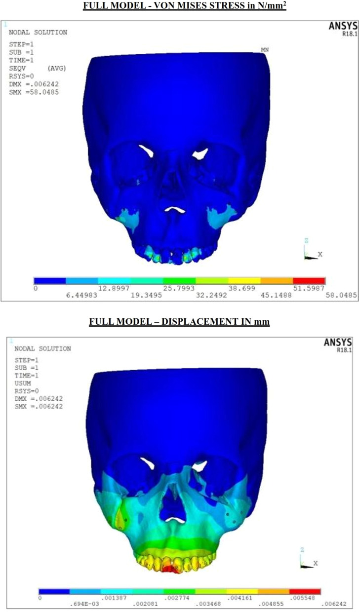 Stress distribution and displacement in the maxillofacial complex during intrusion and distalization of the maxillary arch using miniplates versus mini-implants: a 3-dimensional finite element study.