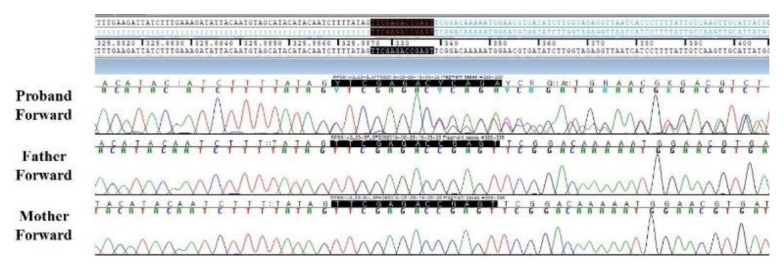 First female Korean child with Coffin-Lowry syndrome: a novel variant in RPS6KA3 diagnosed by exome sequencing and a literature review.