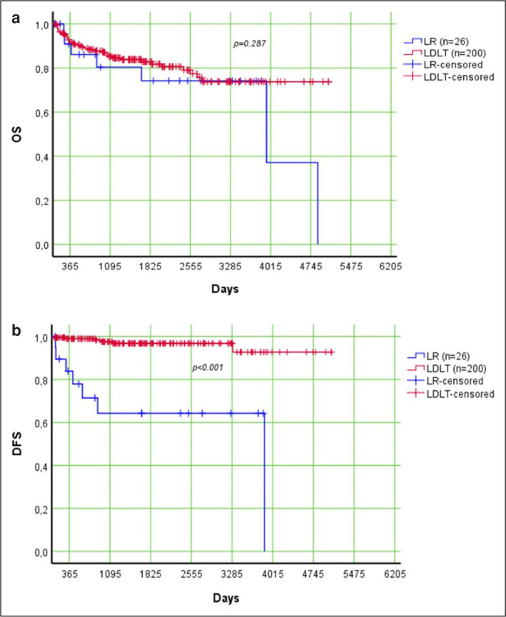 Comparison of liver resection and living donor liver transplantation in patients with hepatocellular carcinoma within Milan criteria and well-preserved liver function.