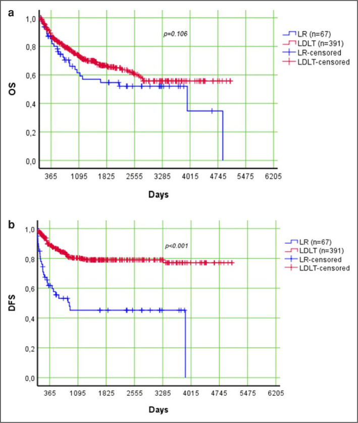 Comparison of liver resection and living donor liver transplantation in patients with hepatocellular carcinoma within Milan criteria and well-preserved liver function.