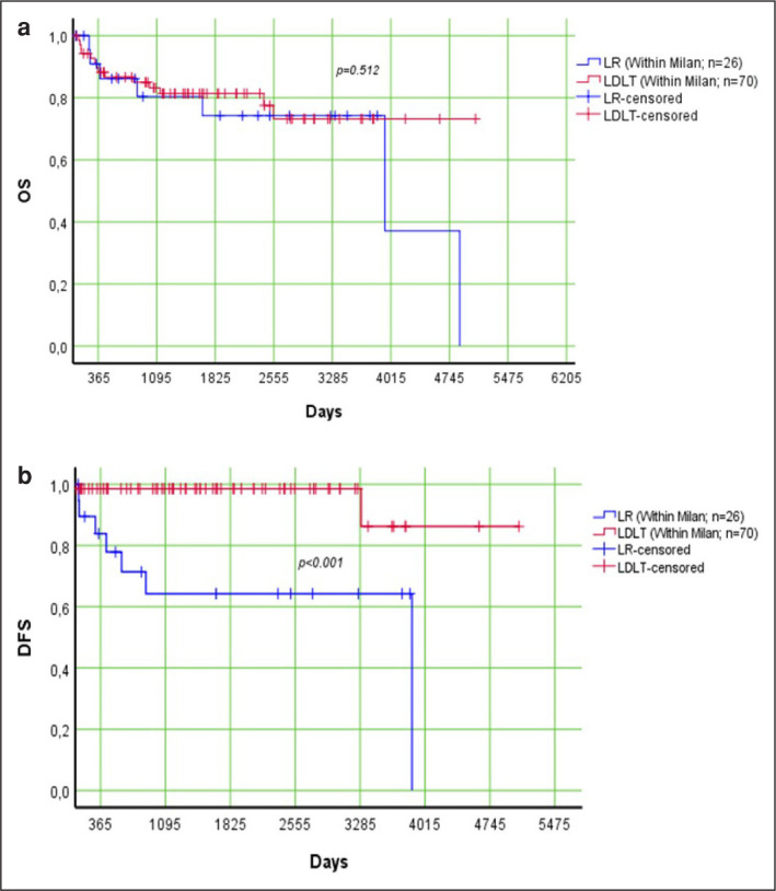 Comparison of liver resection and living donor liver transplantation in patients with hepatocellular carcinoma within Milan criteria and well-preserved liver function.