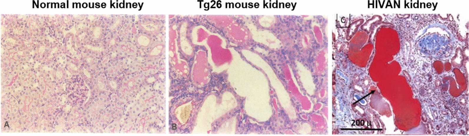 HIV-1 infection of renal epithelial cells: 30 years of evidence from transgenic animal models, human studies and in vitro experiments.