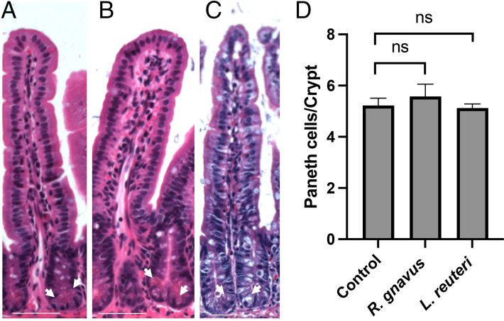 Ruminococcus gnavus and Limosilactobacillus reuteri Regulate Reg3γ Expression through Multiple Pathways.