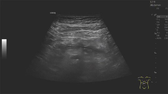 Pancreatic duct imaging during aging.