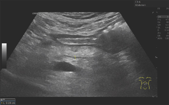 Pancreatic duct imaging during aging.