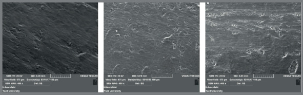 Comparative evaluation of three methods of adhesive remnant removal after orthodontic bracket debonding.