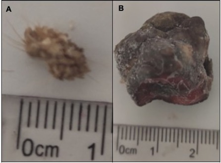 Design, Synthesis, and Evaluation of Peptides Derived from L1 Protein Against Bovine Papillomavirus-1/2 Identified Along Mexico's Cattle Export Route.