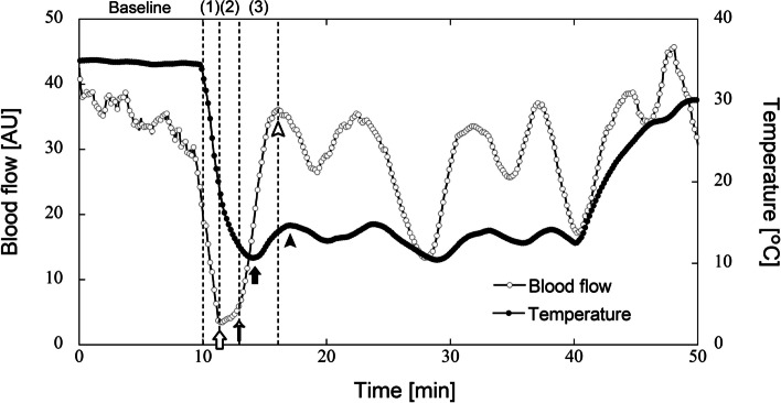 Cold-induced vasodilation response in a Japanese cohort: insights from cold-water immersion and genome-wide association studies.