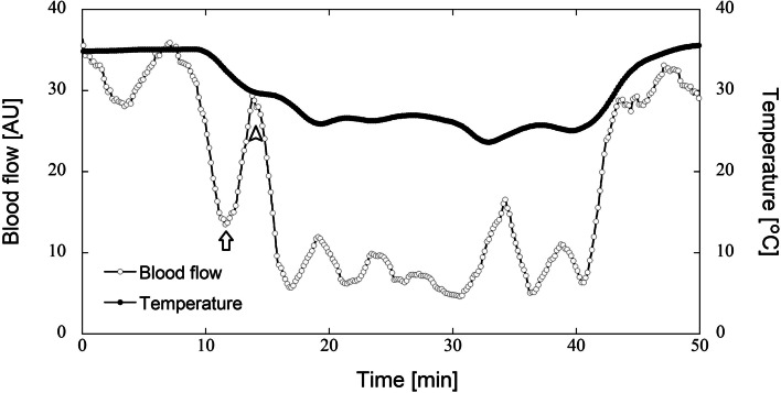 Cold-induced vasodilation response in a Japanese cohort: insights from cold-water immersion and genome-wide association studies.