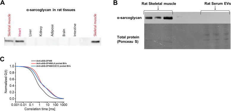 Extracellular vesicle distribution and localization in skeletal muscle at rest and following disuse atrophy.