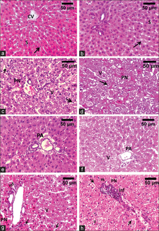 Gold Nanoparticles Down-Regulate Alpha Fetoprotein Expression Induced by Meloxicam Hepatotoxicity in Adult Male Albino Rats: Histological and Immunohistochemical Study.