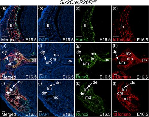 Characterizing expression pattern of Six2Cre during mouse craniofacial development