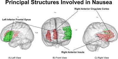 Neural networks involved in nausea in adult humans: A systematic review