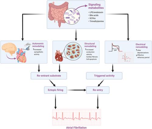 Association of gut microbiome dysbiosis with the progression of atrial fibrillation: A systematic review