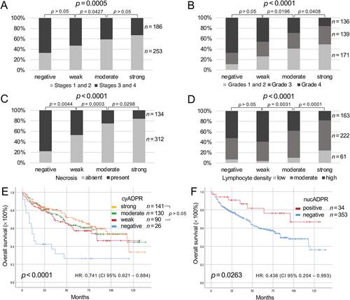 Altered cytoplasmic and nuclear ADP-ribosylation levels analyzed with an improved ADP-ribose binder are a prognostic factor in renal cell carcinoma