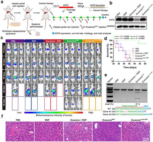 Current advances in non-viral gene delivery systems: Liposomes versus extracellular vesicles