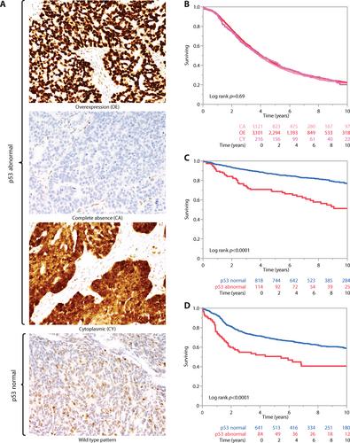 p53 and ovarian carcinoma survival: an Ovarian Tumor Tissue Analysis consortium study