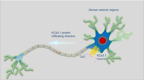 Rhythmic calcium ion activity related to glioma growth reveals the mechanism of ion transmission