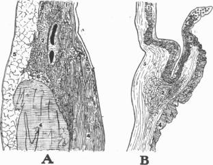 Heinrich Ewald Hering’s discovery of the heart pacemaker: Hering, Tawara and Aschoff’s search for its morphological basis, the sinoatrial node, and why they failed