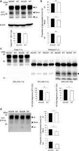 A point mutation in GPI-attachment signal peptide accelerates the development of prion disease