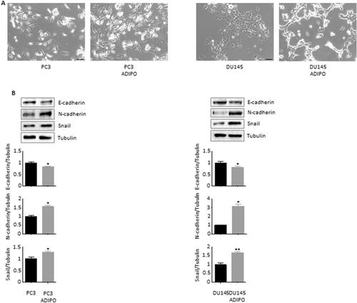 Adipocytes reprogram prostate cancer stem cell machinery