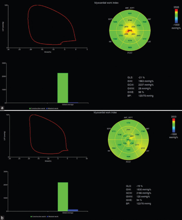 The Influence of Special Military Training on Left Ventricular Adaptation to Exercise in Elite Air Force Soldiers.