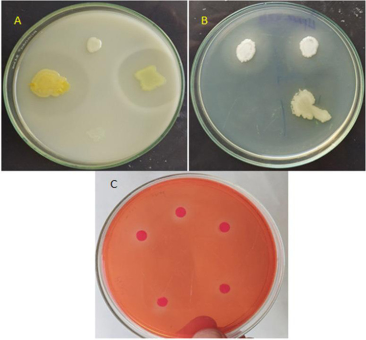 Plant growth promoting and antagonistic traits of bacteria isolated from forest soil samples.