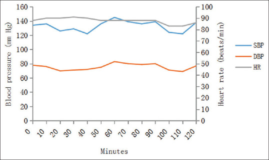 Recurrent syncope in an 84-year-old man.