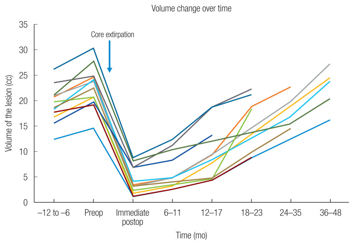 Long-term outcomes after core extirpation of fibrous dysplasia of the zygomaticomaxillary region.